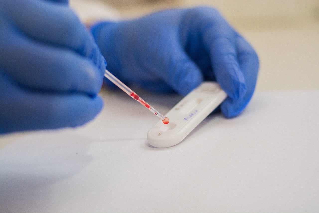 Procon de Juazeiro divulga pesquisa de preços de testes para detecção da Covid-19 em farmácias e laboratórios do município