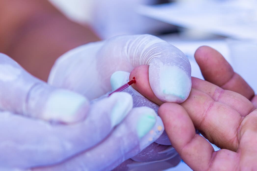 ‘Julho Amarelo’: Juazeiro realiza ação de luta contra as hepatites virais