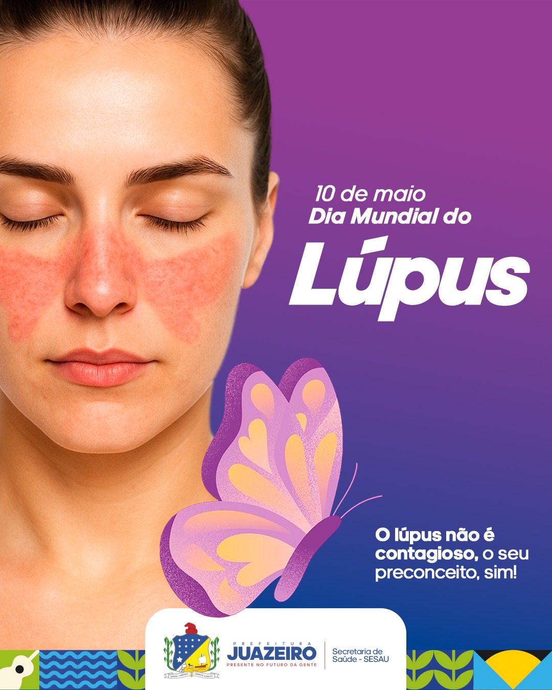 No Dia Mundial do Lúpus, Prefeitura de Juazeiro reforça a conscientização sobre a doença