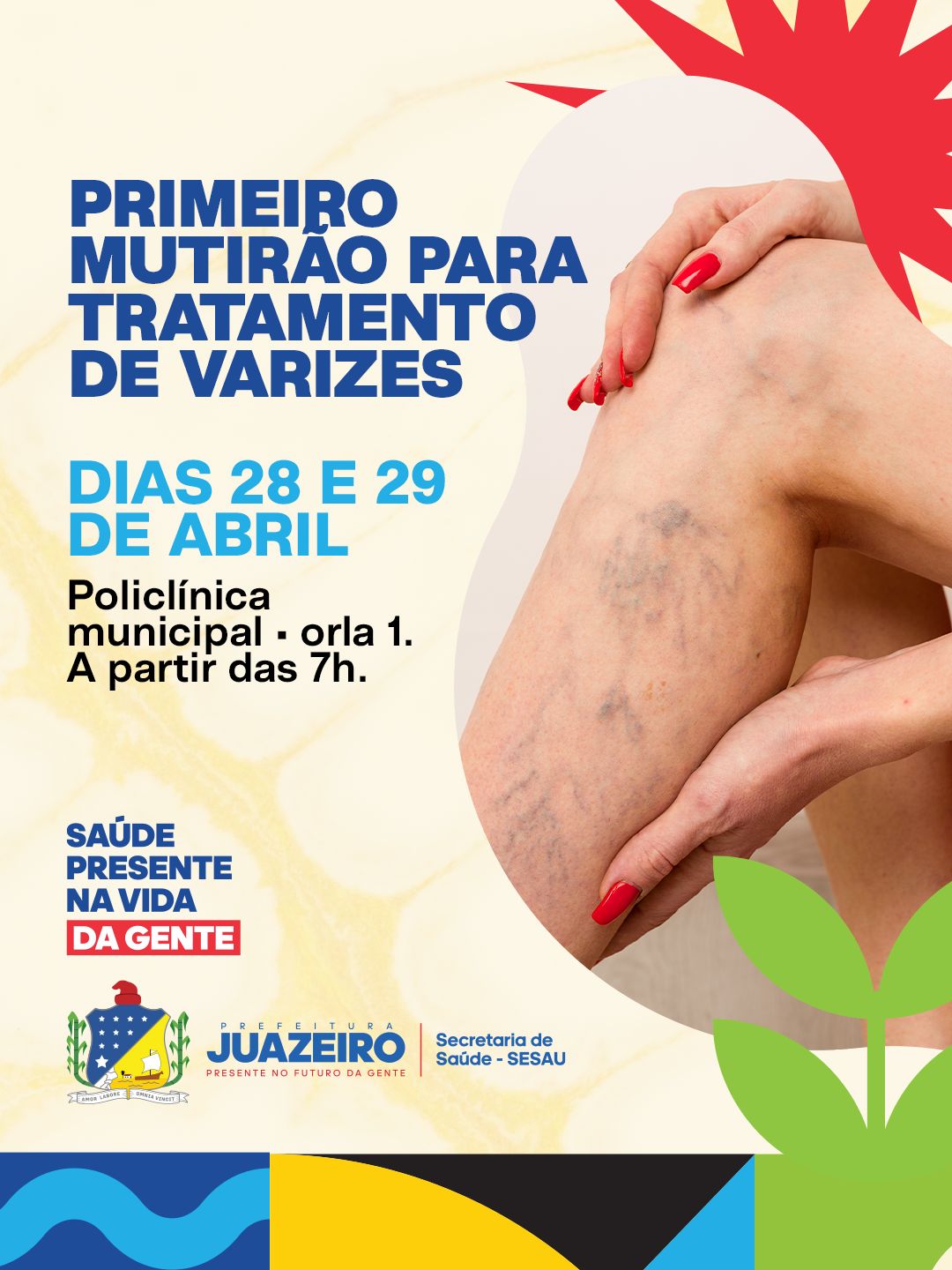 Prefeitura de Juazeiro realiza mutirão inédito para tratamento de varizes