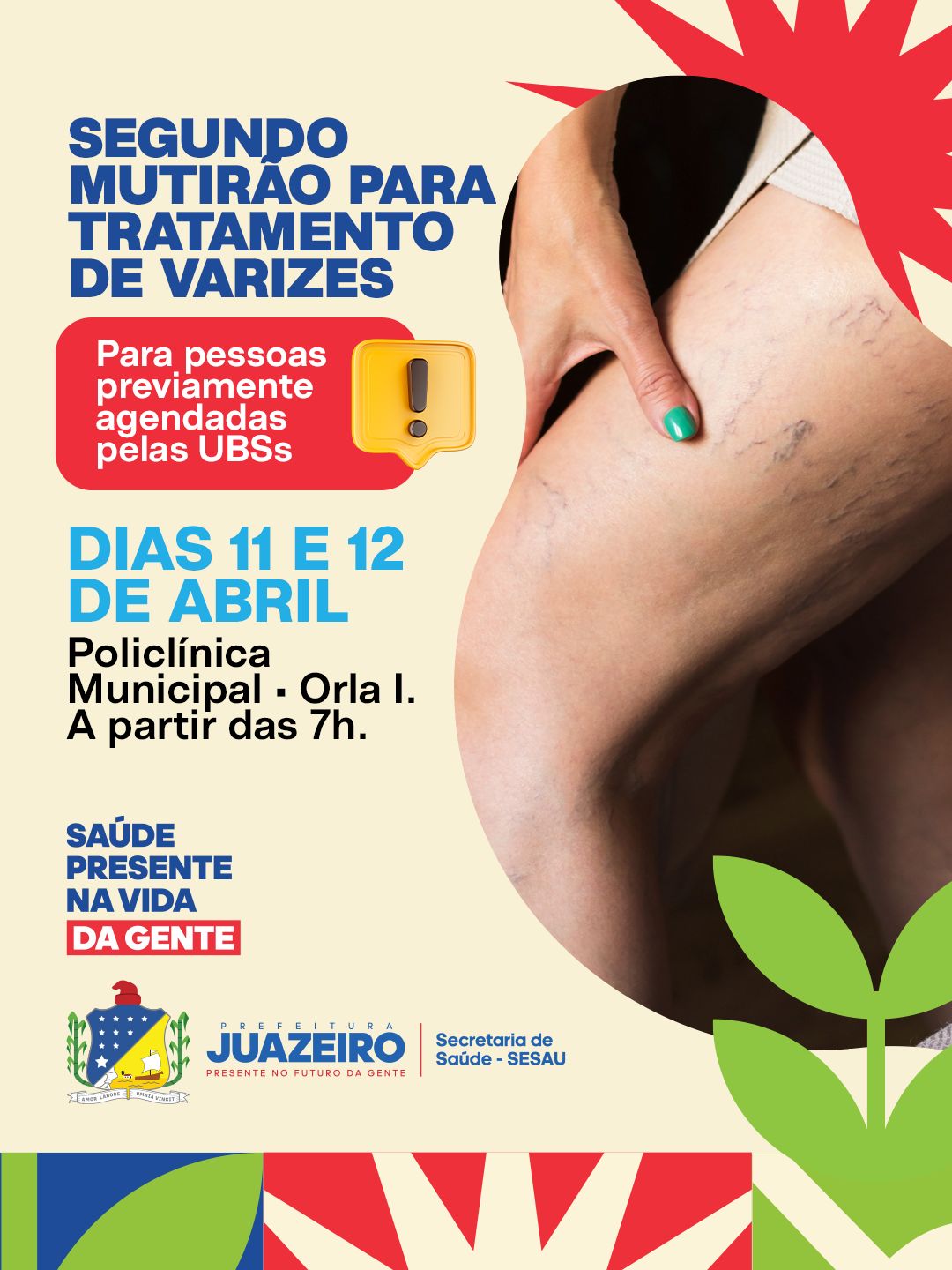 Após sucesso da primeira edição, Juazeiro realiza segundo Mutirão de Tratamento de Varizes